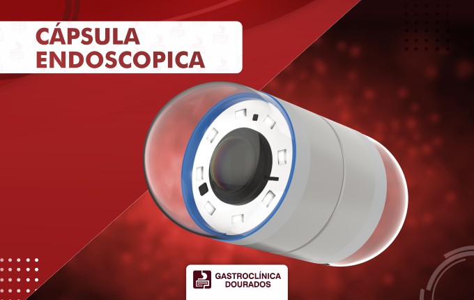 CÁPSULA ENDOSCÓPICA