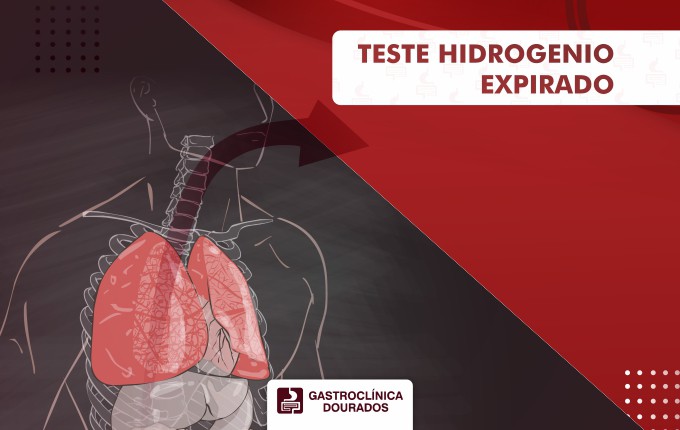 TESTE HIDROGENIO EXPIRADO